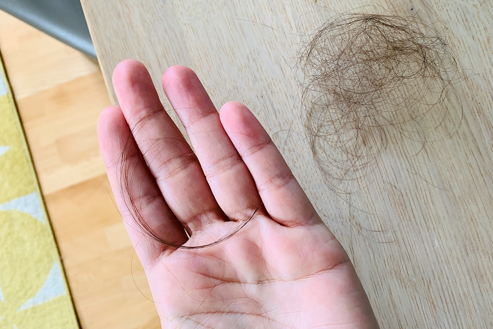 „Ja, sie werden ihre Haare verlieren, Frau Steger!“... diese deutlichen Worte hat meine Ärztin beim Chemo Vorgespräch gewählt. Bis bald, Haare! Hallo KiwiKopf! Mein Weg vom Wuscheldutt zur Glatze. Ein Brustkrebs-Tagebuch.