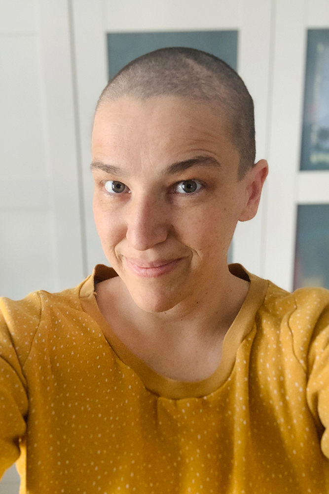„Ja, sie werden ihre Haare verlieren, Frau Steger!“... diese deutlichen Worte hat meine Ärztin beim Chemo Vorgespräch gewählt. Bis bald, Haare! Hallo KiwiKopf! Mein Weg vom Wuscheldutt zur Glatze. Ein Brustkrebs-Tagebuch.
