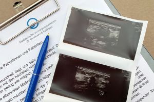 Diagnose: Brustkrebs! Von Hoffnung, Angst und Wartezeiten